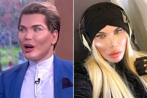 jessica alves before surgery|human ken doll before surgery.